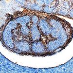 TGFBI Antibody in Immunohistochemistry (Frozen) (IHC (F))