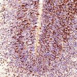 ASCL1 Antibody in Immunohistochemistry (Paraffin) (IHC (P))