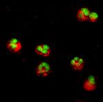 IL1R2 Antibody in Immunocytochemistry (ICC/IF)