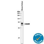 CAR Antibody in Western Blot (WB)