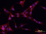 K-cadherin Antibody in Immunocytochemistry (ICC/IF)