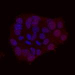 NeuroD1 Antibody in Immunocytochemistry (ICC/IF)