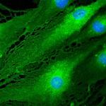 EPCR Antibody in Immunocytochemistry (ICC/IF)