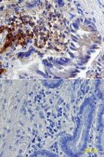 CD138 Antibody in Immunohistochemistry (Paraffin) (IHC (P))