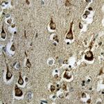 Sortilin Antibody in Immunohistochemistry (Paraffin) (IHC (P))