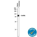 Sortilin Antibody in Western Blot (WB)