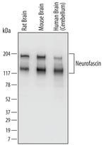 Neurofascin Antibody in Western Blot (WB)