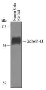 H-cadherin Antibody in Western Blot (WB)