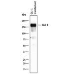 GLI1 Antibody in Western Blot (WB)