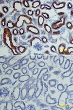 ACE2 Antibody in Immunohistochemistry (Frozen) (IHC (F))