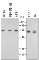 FKBP8 Antibody in Western Blot (WB)