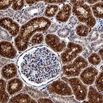 CUBN Antibody in Immunohistochemistry (Paraffin) (IHC (P))