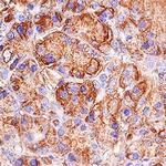 Trypsin Antibody in Immunohistochemistry (Paraffin) (IHC (P))