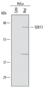 SOX11 Antibody in Western Blot (WB)