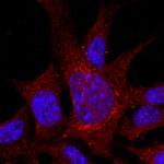 ITGA8 Antibody in Immunocytochemistry (ICC/IF)