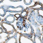 Renin Antibody in Immunohistochemistry (Frozen) (IHC (F))