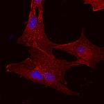 CD73 Antibody in Immunocytochemistry (ICC/IF)