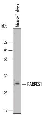 RARRES1 Antibody in Western Blot (WB)