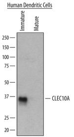 CD301 Antibody in Western Blot (WB)