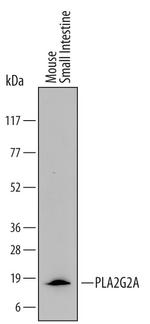 PLA2G2A Antibody in Western Blot (WB)