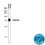 TMEM27 Antibody in Western Blot (WB)