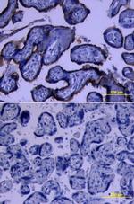 5T4 Antibody in Immunohistochemistry (Paraffin) (IHC (P))