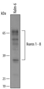 IKAROS Antibody in Western Blot (WB)