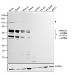 IKAROS Antibody in Western Blot (WB)