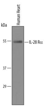 IFNLR1 Antibody in Western Blot (WB)