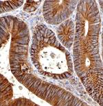 PLXNB2 Antibody in Immunohistochemistry (Paraffin) (IHC (P))