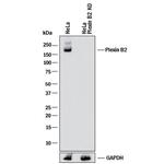 PLXNB2 Antibody in Western Blot (WB)