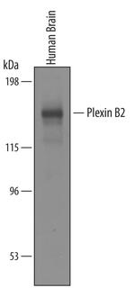 PLXNB2 Antibody in Western Blot (WB)