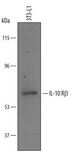 IL10RB Antibody in Western Blot (WB)