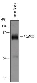 ADAM32 Antibody in Western Blot (WB)