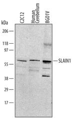 SLAIN1 Antibody in Western Blot (WB)