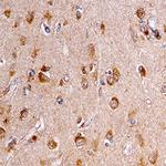 SORL1 Antibody in Immunohistochemistry (Paraffin) (IHC (P))