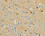 SULT4A1 Antibody in Immunohistochemistry (Paraffin) (IHC (P))