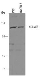 ADAMTS1 Antibody in Western Blot (WB)