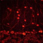 ADNP Antibody in Immunohistochemistry (Frozen) (IHC (F))