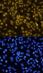 TWIST1 Antibody in Immunocytochemistry (ICC/IF)