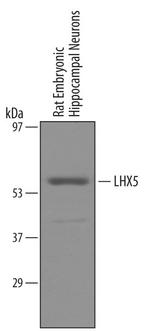 LHX5 Antibody in Western Blot (WB)