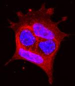 EphA1 Antibody in Immunocytochemistry (ICC/IF)