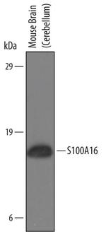 S100A16 Antibody in Western Blot (WB)