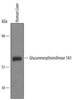 UGT1A1 Antibody in Western Blot (WB)