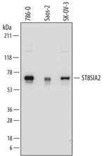 ST8SIA2 Antibody in Western Blot (WB)