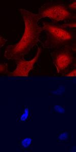 STS1 Antibody in Immunocytochemistry (ICC/IF)