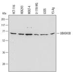 STS1 Antibody in Western Blot (WB)