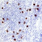 TCL1B Antibody in Immunohistochemistry (Paraffin) (IHC (P))