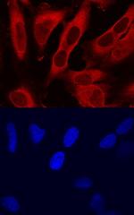 TMSB4X Antibody in Immunocytochemistry (ICC/IF)