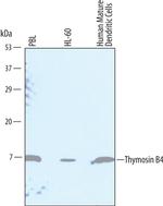 TMSB4X Antibody in Western Blot (WB)